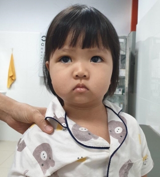 Đang ăn kem thì vấp ngã, bé gái 2 tuổi bị que kem chọc xuyên hốc mắt - Ảnh 2.