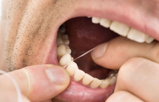 Vệ sinh răng miệng nên được đặt lên hàng đầu trong danh sách ưu tiên của bạn! Quên xỉa răng có thể dẫn đến tình trạng sức khỏe rắc rối hơn. Không có được khía cạnh này của sức khỏe và sức khỏe của bạn đúng có thể dẫn đến bệnh nướu răng. Nghiên cứu trên Tạp chí của Viện Ung thư Quốc gia cho thấy vệ sinh răng miệng kém có thể dẫn đến ung thư đại trực tràng và phổi. 