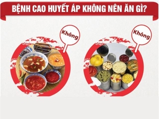 Bệnh cao huyết áp không nên ăn gì? 7 thực phẩm dù thèm mấy cũng phải hạn chế - 1