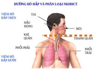 Chứng bệnh lây nhiễm qua đường hô hấp biểu hiện sốt ho, ho khan, ho cơn thở mệt... cũng là triệu chứng điển hình của ôn dịch trong Đông y.