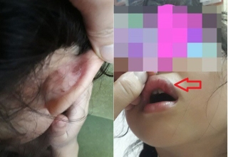 Hà Nội: Cô giáo tiểu học bị tố dùng tay, sách đánh học sinh chảy máu, dập môi tại trường học - Ảnh 1.