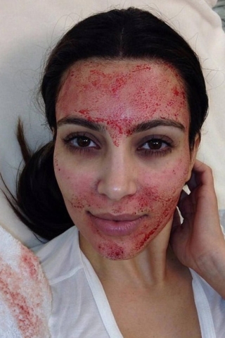Kim Kardashian chia sẻ phương pháp làm đẹp với gương mặt toàn máu