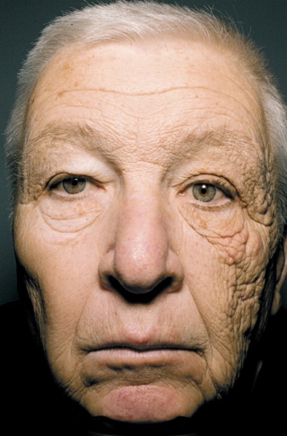 Ai lười bôi kem chống nắng sẽ tởn đến già khi xem những hình ảnh cho thấy tia UV có thể hủy hoại làn da kinh hoàng thế nào - Ảnh 3.