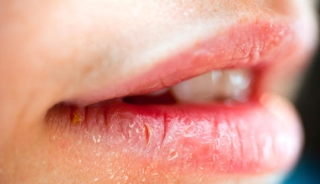 Con gái mắc bệnh phụ khoa thường có 3 đặc điểm khác thường xung quanh vùng miệng, kiểm tra xem bạn có nằm trong số đó - Ảnh 1.