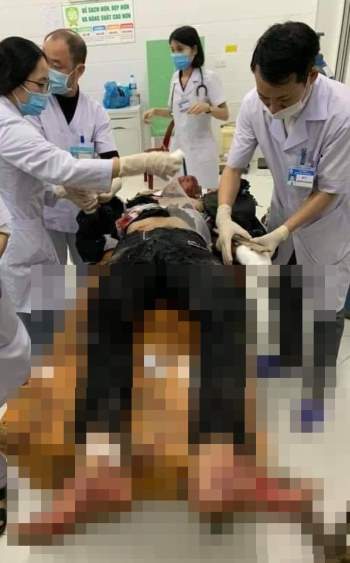 Nghệ An: Lại xảy một vụ nổ lớn khiến 1 học sinh Tu vong - Ảnh 1.