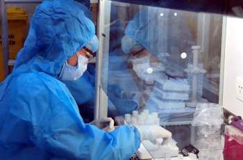 Bệnh nhân người Nhật Tu vong ở Hà Nội nhiễm biến thể mới của SARS-CoV-2 - Ảnh 2.