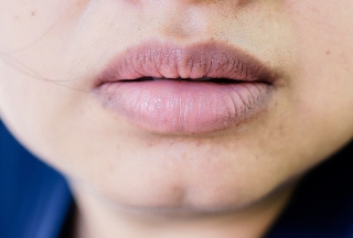 Con gái mắc bệnh phụ khoa thường có 3 đặc điểm khác thường xung quanh vùng miệng, kiểm tra xem bạn có nằm trong số đó - Ảnh 2.