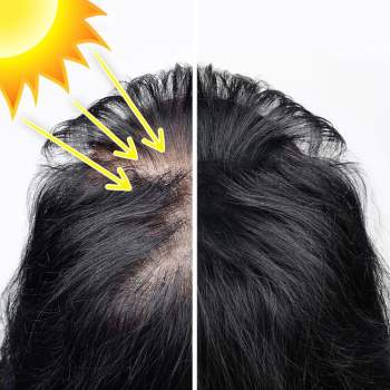 8 thói quen hàng ngày dễ khiến mái tóc ngày càng mỏng đi rõ rệt - Ảnh 2.