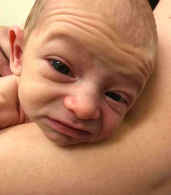 Chùm ảnh: Những em bé sơ sinh có khuôn mặt “già như trái cà” khiến cha mẹ được một phen “hết hồn” nhưng lại gây bão mạng thế giới - Ảnh 22.