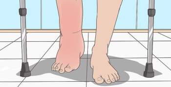 Soi tay chân cũng có thể nhận biết được 5 biểu hiện cảnh báo bạn có nguy cơ mắc ung thư hay không - Ảnh 3.