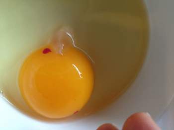 4 loại trứng chả bổ béo gì nhưng nhiều người vẫn tiếc rẻ mà cố ăn khiến sức khỏe bị tổn hại mà không hay biết - Ảnh 3.
