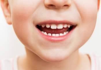 Giải pháp phòng tránh sâu răng đơn giản và an toàn cha mẹ có thể làm cho con ngay từ khi mọc chiếc răng sữa đầu tiên - Ảnh 1.