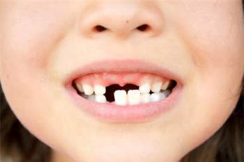 3 bệnh răng miệng thường gặp ở trẻ nhỏ