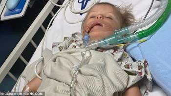 Một cục pin cúc áo nằm mắc kẹt trong cổ họng của bé gái 11 tháng tuổi suốt 4 tháng trời vì bác sĩ chẩn đoán bệnh sai - Ảnh 3.