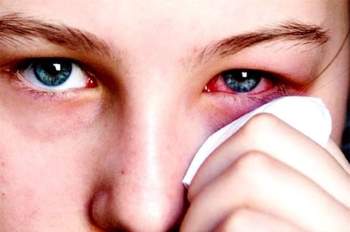 4 sai lầm khi điều trị đau mắt đỏ bạn cần tránh