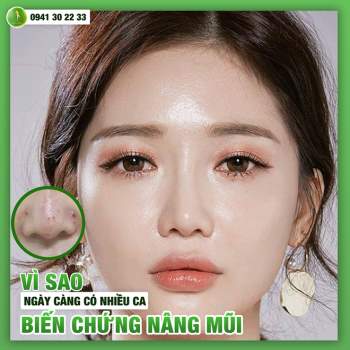 Thạc sĩ - bác sĩ Nguyễn Tiến Huy, một niềm trăn trở khắc phục thẩm mỹ hỏng - ảnh 1