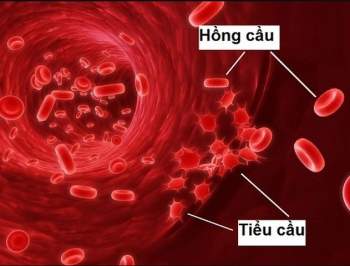Tìm hiểu thêm về bệnh giảm hồng cầu