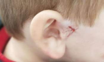 Thêm vụ cậu bé bị thương nặng ở tai vì chiếc móc áo bằng kim loại khiến các bà mẹ hoảng sợ - Ảnh 1.
