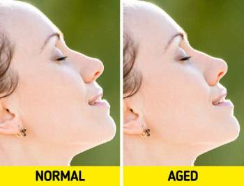 8 dấu hiệu trên khuôn mặt cho thấy bạn đang bắt đầu lão hóa nhanh hơn - Ảnh 5.