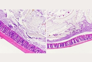 Hình ảnh phóng đại ruột trước và sau ( ảnh trái và phải) sau khi ăn khẩu phần nhiều đường 7 ngày.