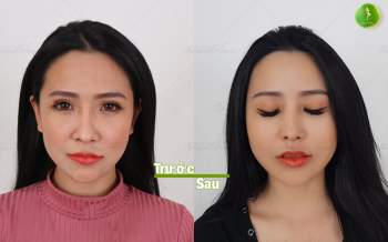 Thạc sĩ - bác sĩ Nguyễn Tiến Huy, một niềm trăn trở khắc phục thẩm mỹ hỏng - ảnh 6