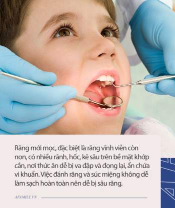 7 nguyên nhân gây sâu răng hàng đầu ở trẻ em và 3 điều cần lưu ý để chữa trị - Ảnh 3.