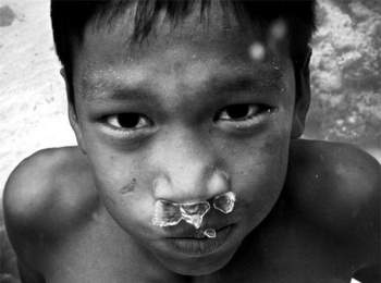 Trẻ em tộc người cá bí ẩn ở Thái - 9