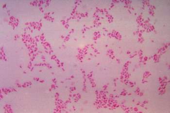 Vi khuẩn Bacteroides fragilis có nguy cơ gây ung thư vú