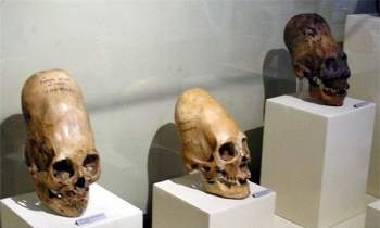 Những hộp sọ siêu dài được tìm thấy ở vùng Tây Âu
