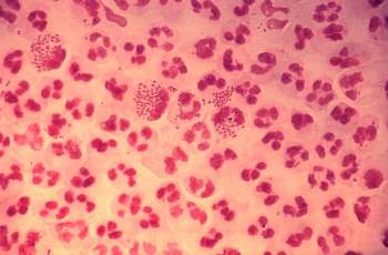 Vi khuẩn Neisseria gonorrhoeae gây bệnh lậu