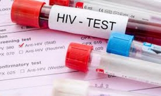 Các dịch vụ phòng ngừa, xét nghiệm HIV có thể không đến được đối tượng đích trong đại dịch.