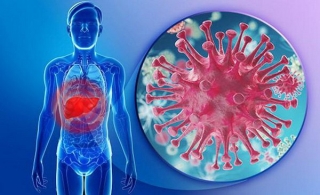 Viêm gan siêu vi là một trong những bệnh truyền nhiễm phổ biến nhất trên thế giới.