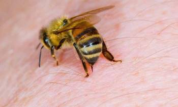 Nọc ong mật có thể tiêu diệt tế bào ung thư.