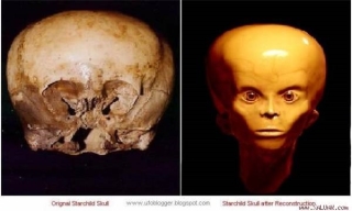 Hộp sọ và hiện tượng kỳ lạ minh chứng về sự sống ngoài hành tinh