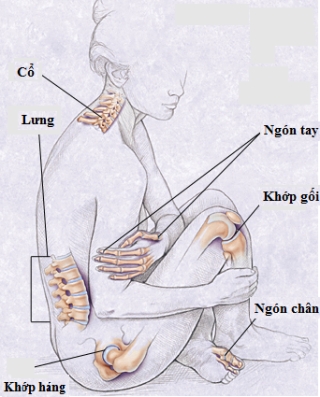 Thoái hóa khớp và các biện pháp ứng phó