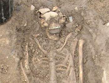 Hình ảnh bộ xương với hòn đá ngậm trong miệng. Ảnh: Daily Mail