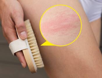 7 sản phẩm skincare quen thuộc có thể làm hỏng da của bạn Ảnh 4