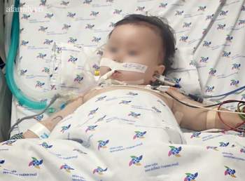Bé gái 15 tháng tuổi bị tay chân miệng nguy kịch, phải chuyển viện liên tục 3 tuyến để cứu mạng - Ảnh 1.