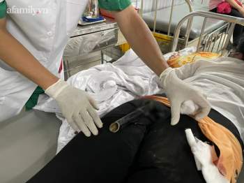 Cấp cứu cô gái 19 tuổi bị chân chống xe máy cắm sâu vào mông ngày 30 Tết - Ảnh 1.