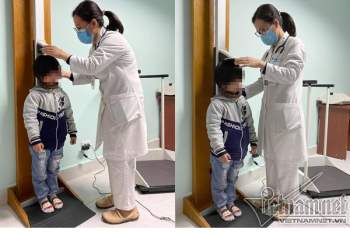 Bác sĩ giúp bé gái tí hon ở Thái Bình cao thêm 29 cm sau 2 năm