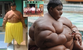Hành trình giảm cân ngoạn mục của cậu bé béo nhất thế giới nặng gần 200kg khi mới 10 tuổi nhưng để lại cơ thể bị chảy xệ gây ám ảnh - Ảnh 2.