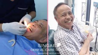 Bị tiểu đường bay từ Séc về Việt Nam trồng răng Implant