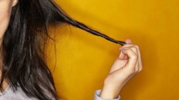 Trẻ mắc hội chứng “nghiện giật tóc” nhưng nhiều bố mẹ chủ quan - Ảnh 1.