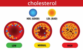 thừa cholesterol