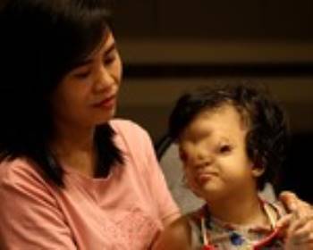 Mẹ của cô bé có khuôn mặt biến dạng ở Quảng Bình gửi con để đi giúp người dân chống lũ