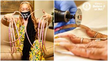 Dị nhân cắt bỏ bộ móng tay dài nhất thế giới