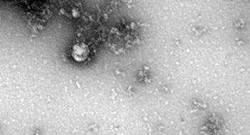 Các nhà sản xuất vaccine gấp rút đổi kế hoạch ứng phó biến thể virus SARS-CoV-2 - Ảnh 1.