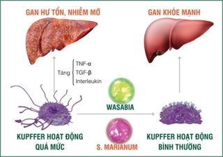 ‘Điểm mặt’ những nguyên nhân gây bệnh gan nhiễm mỡ - ảnh 3