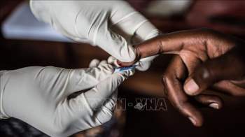 Liên hợp quốc tin tưởng có thể đẩy lùi bệnh HIV/AIDS vào năm 2030 - Ảnh 1.