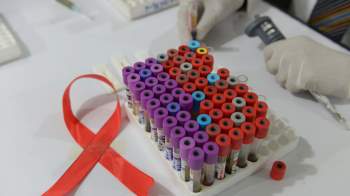Sắp thử nghiệm vaccine ngừa HIV/AIDS trên người sau 8 năm nghiên cứu - Ảnh 2.